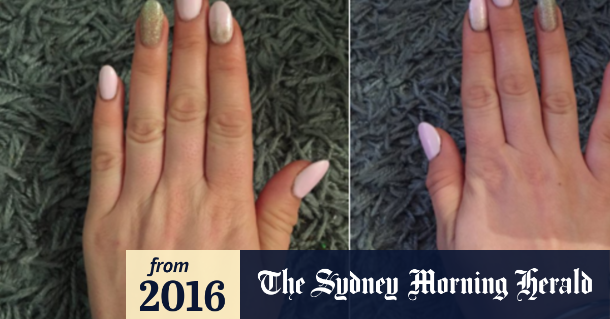 Is 'smartphone pinky' real? Probably not, but phones can still cause damage